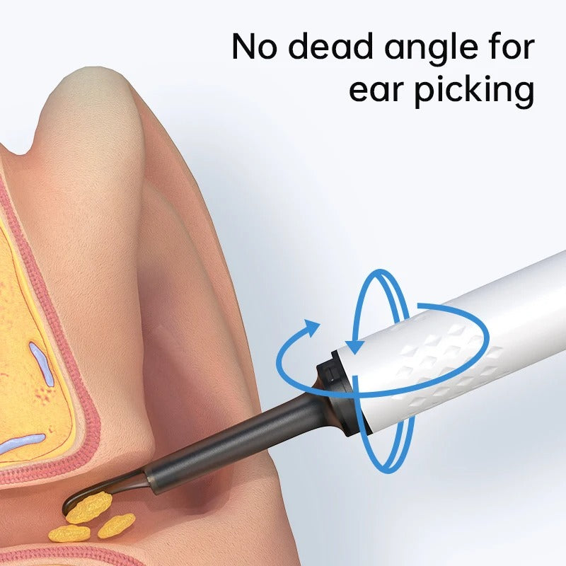 Visual Ear Cleaner